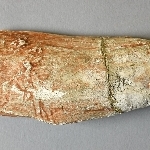 665151