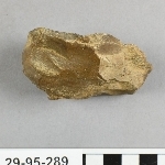 794157