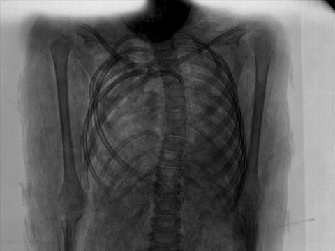 Testing Classical Stereotypes: Radiology of Egyptian Mummification's Evisceration Tradition thumbnail.