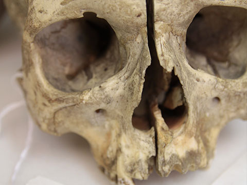 From Skulls and Scans thumbnail.